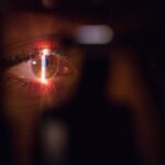 7 Critical Disadvantages of Cataract Surgery You Need to Know