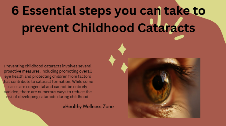 childhood cataracts